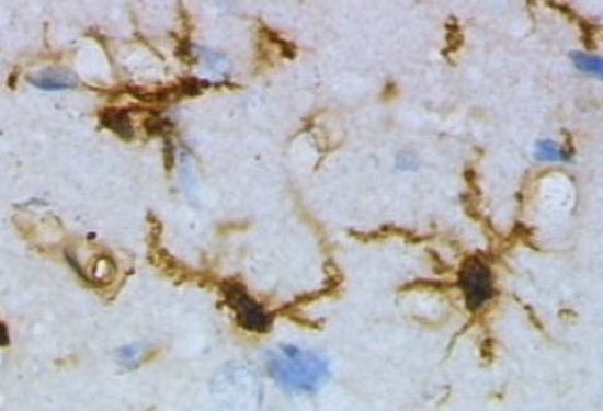 Mikroglej_1 - Grzegorz Wicher microglia
