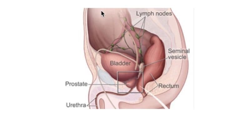 Prostate and nearby organs - NCI Prostate and nearby organs - NCI