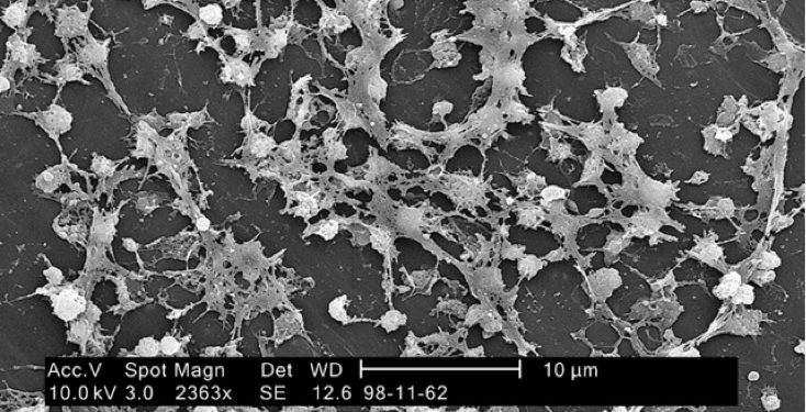 mrsa biofilm CDC mrsa biofilm CDC