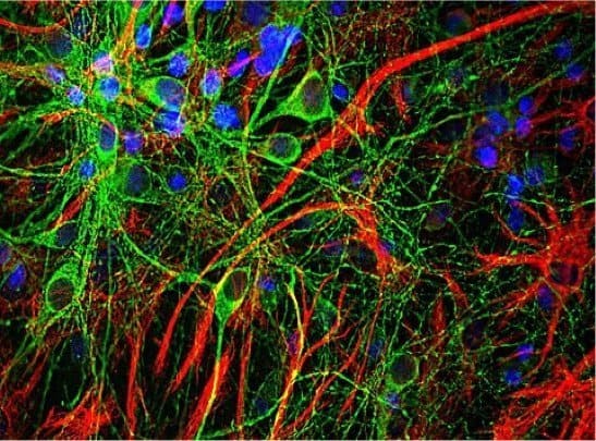 480px-CPCA-GFAP,MCA-5B10,Tau,neurons 480px-CPCA-GFAP,MCA-5B10,Tau,neurons