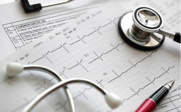 Depositphotos_24557375_m-2015 ECG, electrocardiogram, heart