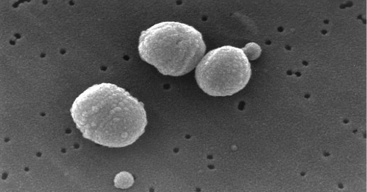 Streptococcus_pneumoniae Streptococcus_pneumoniae