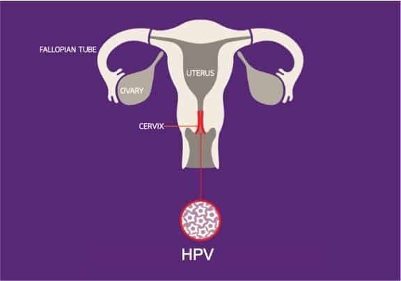 cervical_cancer_icon3-lovecoffeedesign cervical_cancer_icon3-lovecoffeedesign