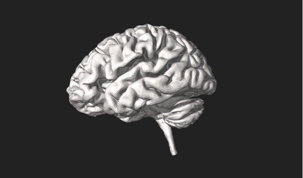 Abnormal brain proteins correlate with aggressive behavior in dementia