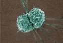 Breast cancer study uncovers how macrophages may contribute to a therapeutic weak spot