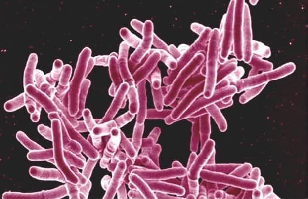 Mycobacterium_tuberculosis_Bacteria,_the_Cause_of_TB_(5149398656) Mycobacterium_tuberculosis_Bacteria,_the_Cause_of_TB_(5149398656)