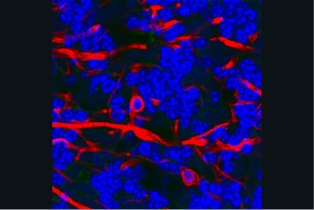 lossy-page1-480px-Oligodendendrocytes_in_rat_brain lossy-page1-480px-Oligodendendrocytes_in_rat_brain