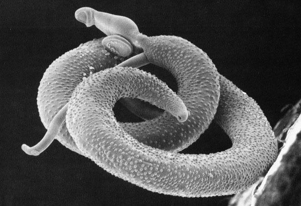 Therapy derived from parasitic worms downregulates proinflammatory pathways