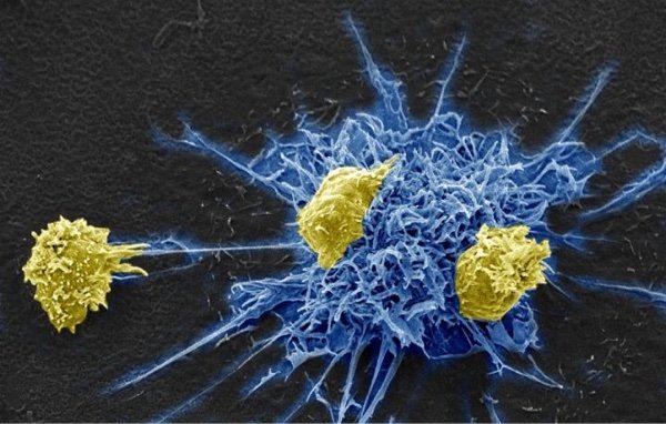 Immunotherapy kicks and kills HIV by exploiting a common virus