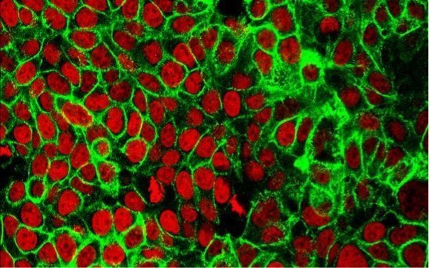 198911_web - NIH 198911_web - NIH