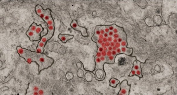 Synthetic DNA-encoded antibody rapidly protects mice and monkeys from Zika