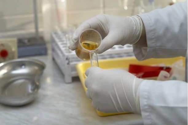 Urine test could prevent cervical cancer