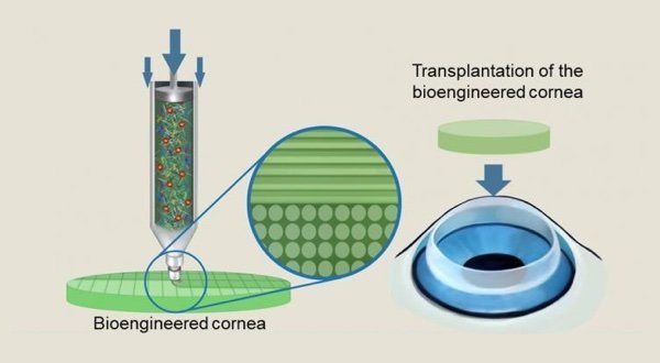 Scientists create 3D printed transparent artificial corneas