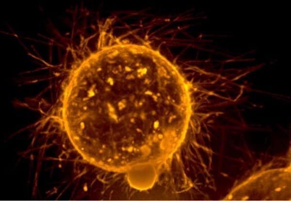 204655_web - NCI Breast tumor cell