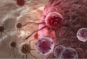 Researchers discover mechanism that regulates immune cell anti-tumor activity