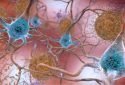 Brain cholesterol regulates Alzheimer's plaques