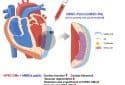 Novel dual stem cell therapy improves cardiac regeneration