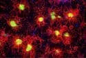 Genetic variation in individual brain cell types may predict disease risk