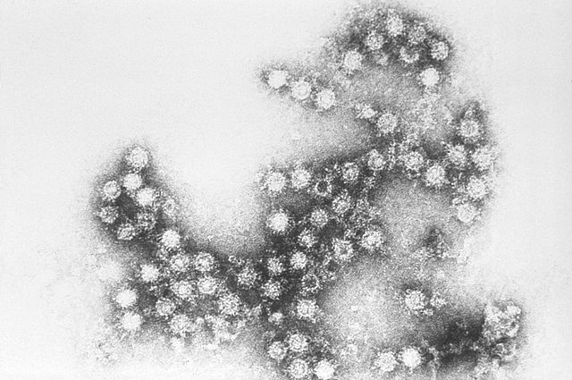 640px-Coxsackie_B4_virus 640px-Coxsackie_B4_virus