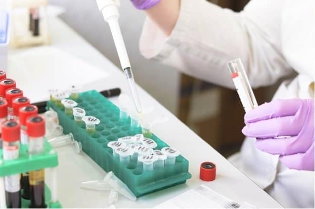 laboratory-3827738_640 Blood test, laboratory test