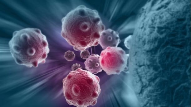 Researchers identify protein that blocks immune cells from entering and killing breast tumors