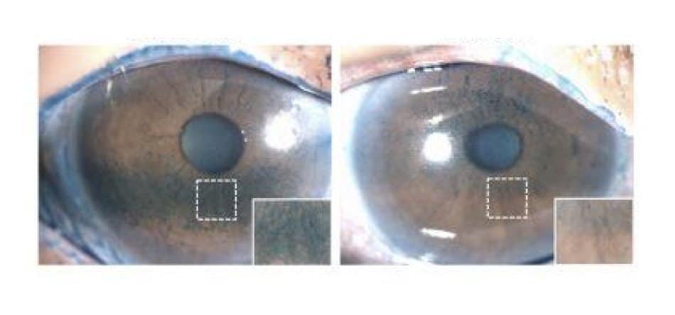 213850_web - Sandeep Jain, et al 213850_web - Sandeep Jain, et al