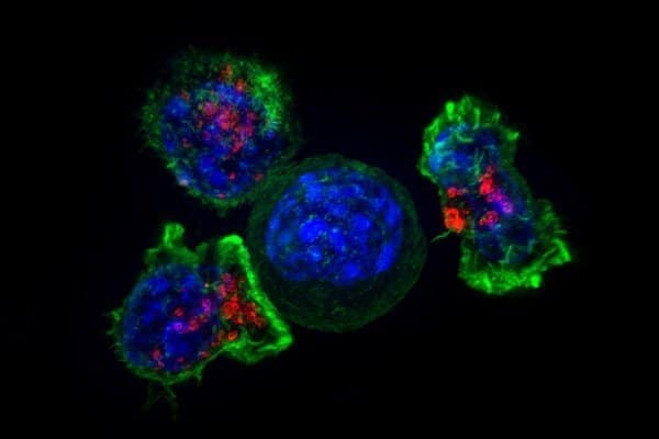 ‘Bad fat’ suppresses cancer-fighting killer T cells