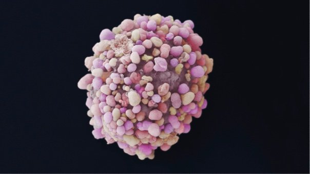 Zooming in on breast cancer reveals how mutations shape the tumor landscape