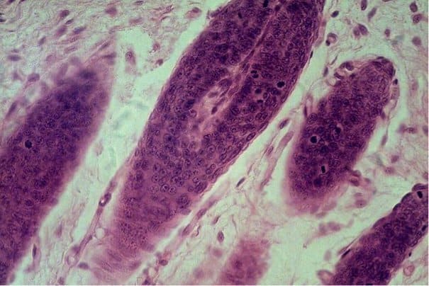 640px-Hair_Follicles_in_Mammal_Skin hair follicles