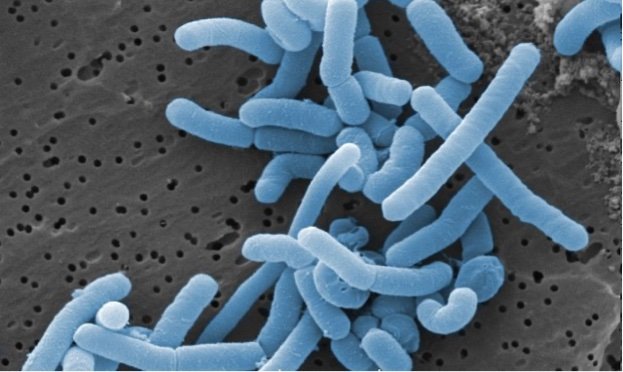 640px-Lactobacillus_paracasei 640px-Lactobacillus_paracasei