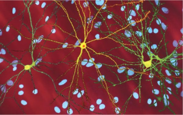 Neuron_with_mHtt_inclusion Neuron_with_mHtt_inclusion