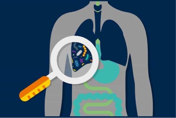 Lung microbiome may help predict outcomes in critically ill patients
