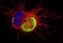 Consequences of Zika virus attack on astrocytes