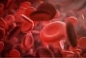 Gene therapy for thalassemia ends need for blood transfusions in young children