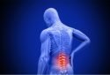 'Swiss cheese' bones could be cause of unexplained low back pain