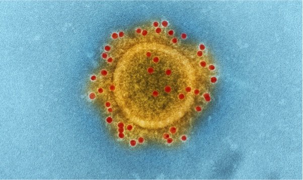 cdc-BbP7rqIGB3c-unsplash MERS coronavirus