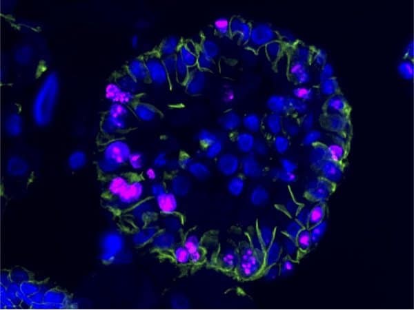 224211_web - Birchmeier Lab - MDC 224211_web - Birchmeier Lab - MDC