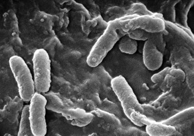 640px-Pseudomonas_aeruginosa_SEM 640px-Pseudomonas_aeruginosa_SEM