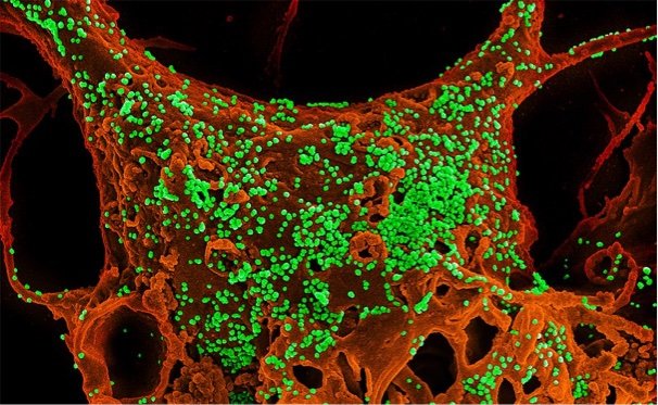 807px-MERS_Coronavirus_Particles 807px-MERS_Coronavirus_Particles