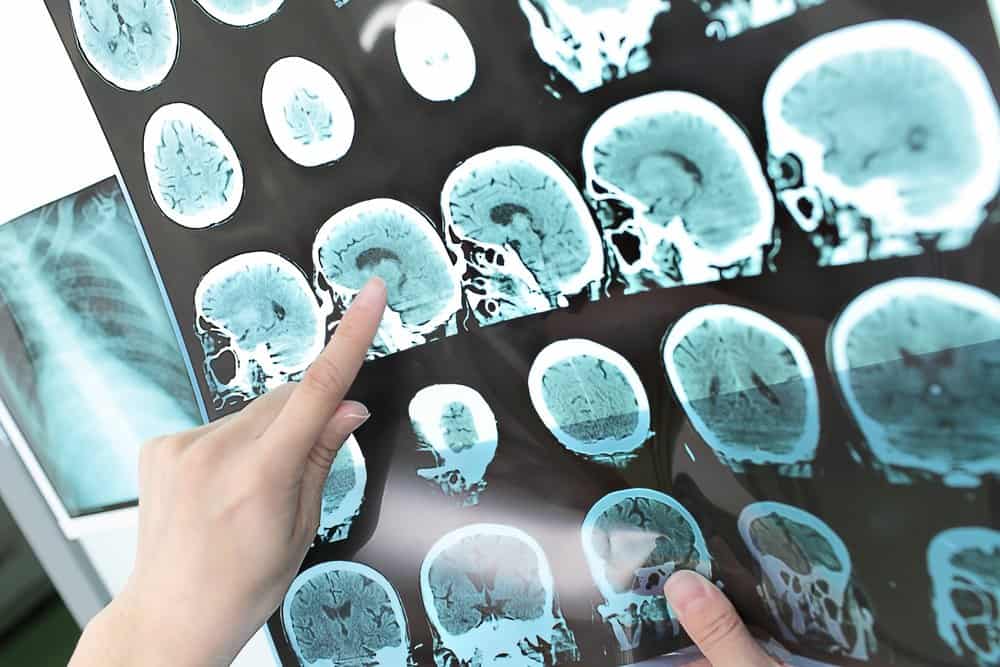 doctor view output CT scan. doctor view output CT scan.