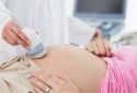 Diet and lifestyle during pregnancy linked to modifications in infants' DNA