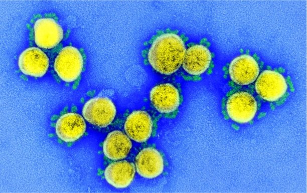 49645120251_a1376e74a0_b SARS-CoV-2, coronavirus