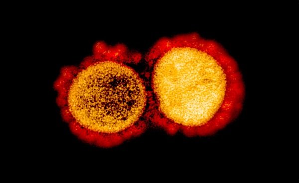 Some COVID-19 patients still have coronavirus after symptoms disappear
