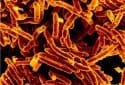 Cough that spreads tuberculosis has pain-linked trigger