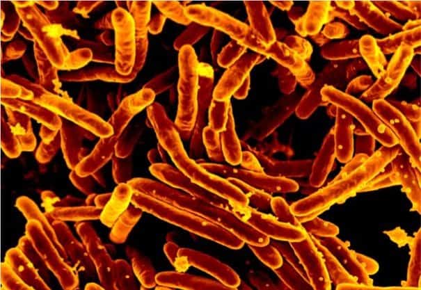 Blocking iron transport could stop tuberculosis
