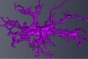 Autism in males linked to defect in brain immune cells, microglia