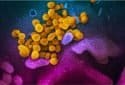 FDA-approved anti-parasitic drug blocks novel coronavirus replication