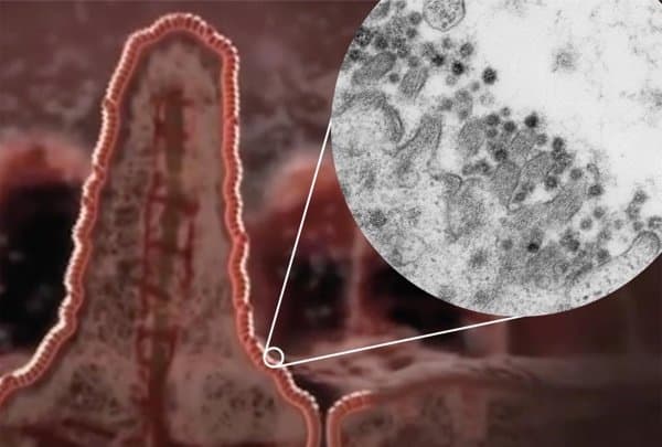 Coronavirus SARS-CoV-2 infects cells of the intestine