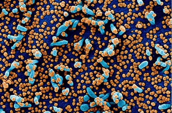 A comprehensive profile of California’s ‘homegrown’ SARS-CoV-2 virus