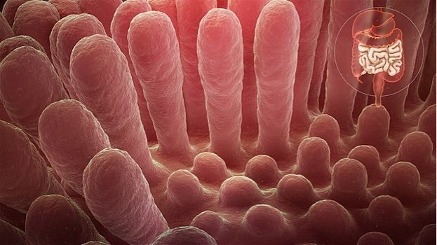 640px-Inflammed_mucous_layer_of_the_intestinal_villi_depicting_Celiac_disease celiac disease